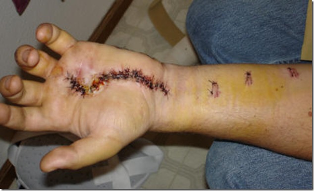 Article_Image_Into_The_Fray